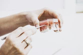 Implanty zębowe nowatorską inwestycją w zdrowie 