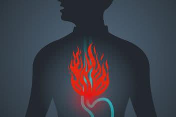 Refluks gorszy, niż go malują