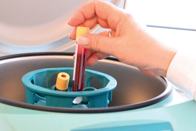 Jak diagnozuje się miażdżycę? 