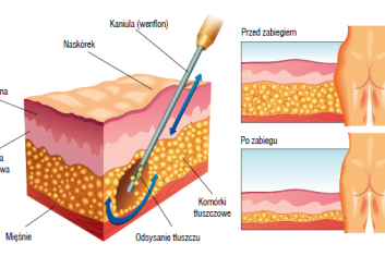 Są sposoby NA PIĘKNE NOGI!