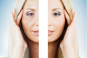 Młodsza bez skalpela