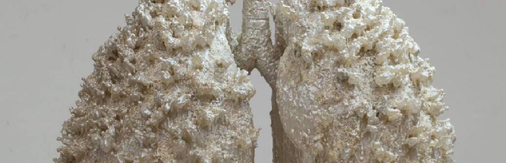 Światowy Dzień Spirometrii