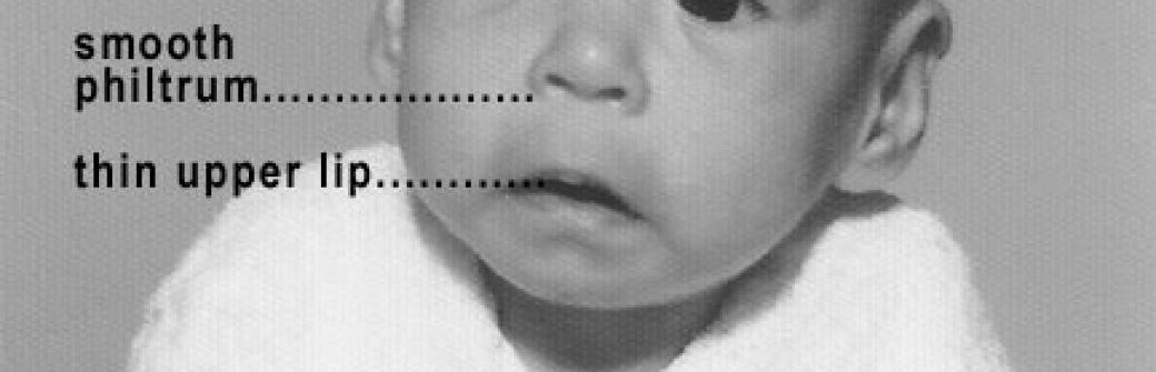 Światowy Dzień FAS