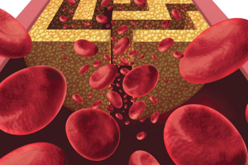 Prawdziwa przyczyna miażdżycy