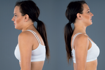 Terapia manualna skolioz u dorosłych