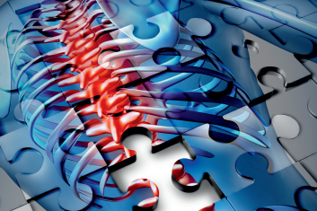 Uraz kręgosłupa i rdzenia kręgowego