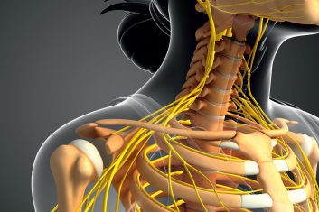 Fizjoterapia w przypadku pleksopatii pourazowej