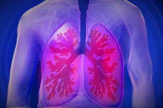 COVID-19: Przeszczep płuc od osoby po covidzie 