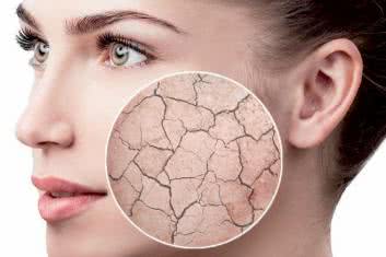Sposoby na suchą skórę