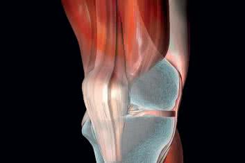 Zespół bólowy przedniego aspektu kolana