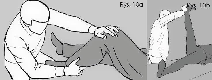 Diagnoza ślizgu nerwy kulszowego