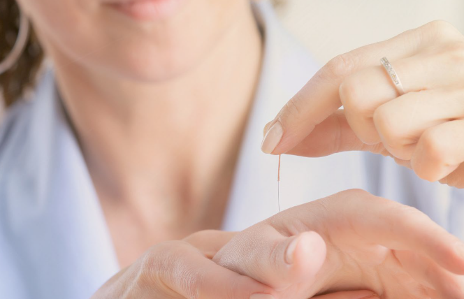 Akupunktura lepsza niż opioidy