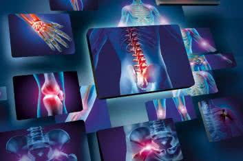 Gdy hormony tarczycy atakują kości i stawy