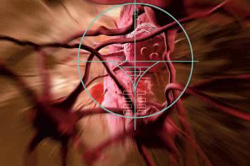 Wyjątkowy stan przedrakowy