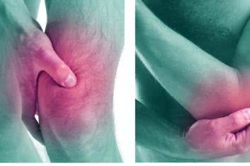 Ból mięśniowo-szkieletowy. Aktualizacja epidemiologiczna