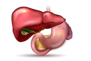 Kamica żółciowa - objawy, przyczyny i leczenie