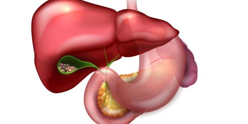 Kamica żółciowa - objawy, przyczyny i leczenie