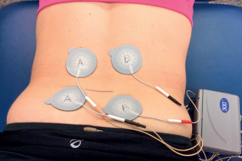 Przegląd urazów międzykręgowych krążków lędźwiowych – implikacje kliniczne