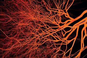 Osteopatyczna terapia naczyń wisceralnych