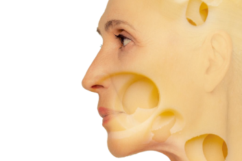 Alzheimer: ser silniejszy od genów