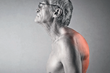 Hiperkifoza: zaburzenia postawy u osób starszych