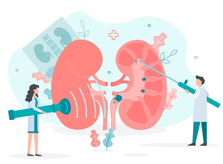 Usuwanie kamieni nerkowych