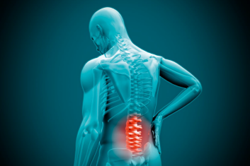 Kiedy mniej znaczy więcej – studium przypadku przewlekłego bólu pleców