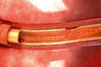 Identyfikacja patologii naczyniowych. Ważne aspekty w rozumowaniu klinicznym