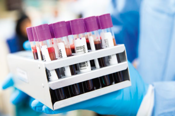 Przełomowa biopsja. Prosty test krwi sprawi, że pobieranie tkanek nie będzie konieczne...