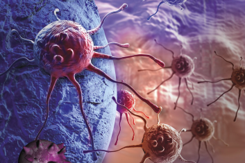 Cholesterol karmi raka!