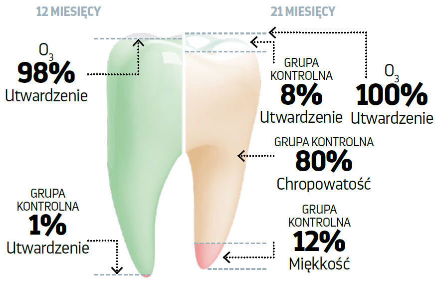Grafika przedstawiająca wyniki badania wpływu ozonoterapii na stan zęba