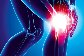 Zastosowanie tapingu przy zespole bólu rzepkowo-udowego