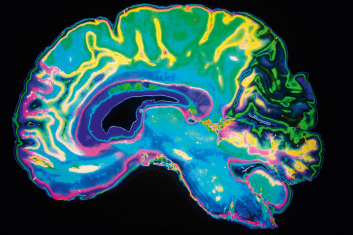 Neurofeedback funkcjonalnego rezonansu magnetycznego w rehabilitacji poudarowej