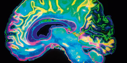 Neurofeedback funkcjonalnego rezonansu magnetycznego w rehabilitacji poudarowej