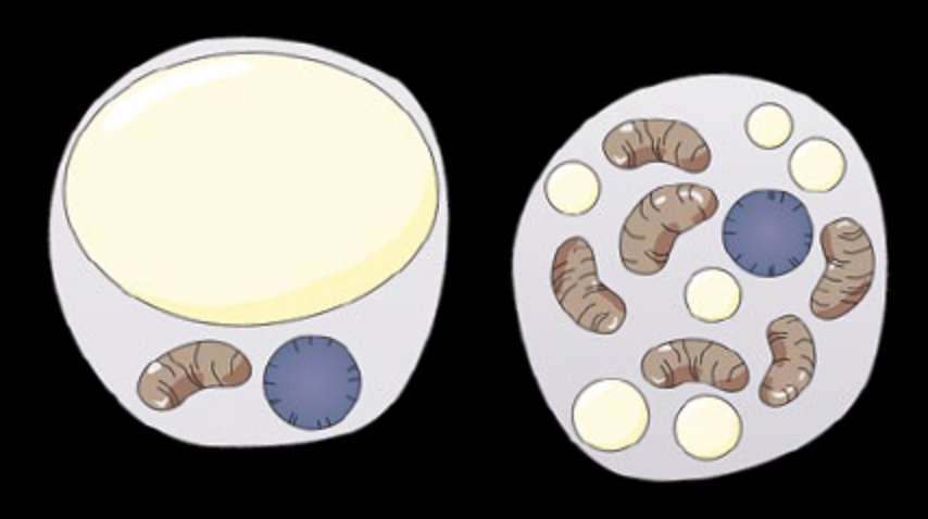 Żółta i brunatna komórka tłuszczowa