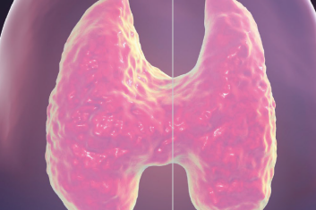 Chora tarczyca podgryza kości