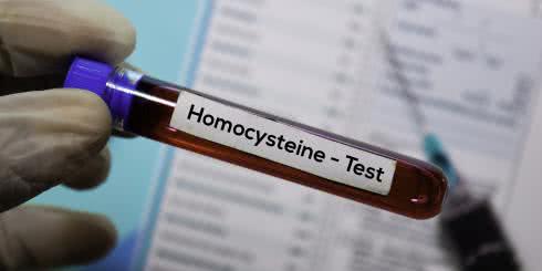 Niedobory witamin z grupy B a wysoki poziom homocysteiny