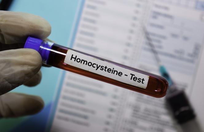 Niedobory witamin z grupy B a wysoki poziom homocysteiny