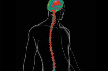 Terapia manualna w niekorzystnym napięciu nerwowym opony twardej i rdzenia kręgowego