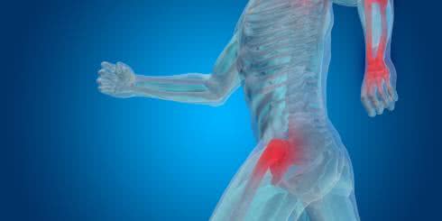 Suplement na zdrowe stawy. Zadbaj o sprawne stawy.