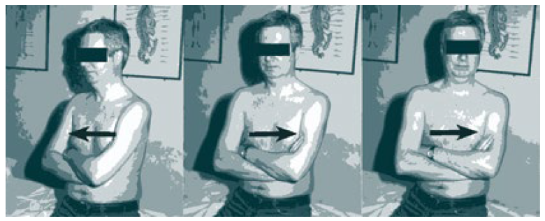 Rotacja dolnej części klatki piersiowej