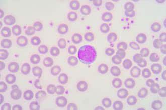 Limfocyty – funkcje, normy, choroby