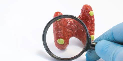 Przytarczyce - co to jest i do czego służy?