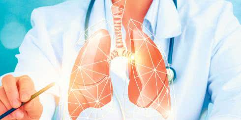 Przewlekła obturacyjna choroba płuc - Czy tylko palacze mają POChP? 