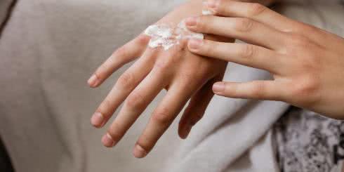 6 sposobów na radzenie sobie z łuszczycą