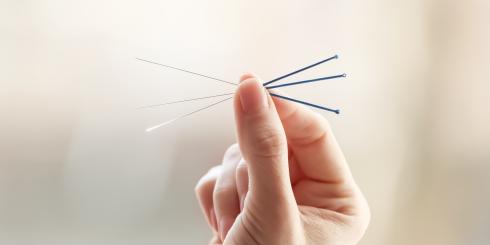 Na czym polega akupunktura twarzy i jakie daje efekty?
