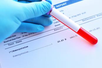 Wysoki poziom homocysteiny - bagatelizowane zagrożenie