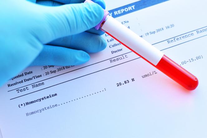 Wysoki poziom homocysteiny - bagatelizowane zagrożenie