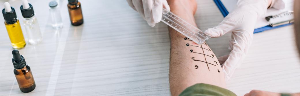 Alergia - skąd bierze się uczulenie i jak je rozpoznać?