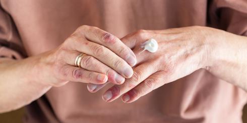 Więcej niż uczulenie. Atopowe zapalenie skóry i alergia pokarmowa 